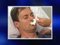 Nasal-Aire II Critical Care Instructional Video