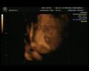 Ecograf�a 3D Luciano Jim�nez