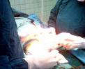Cauterization,Electrocautery