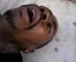 crackhead OD `s crazy shit Part 2