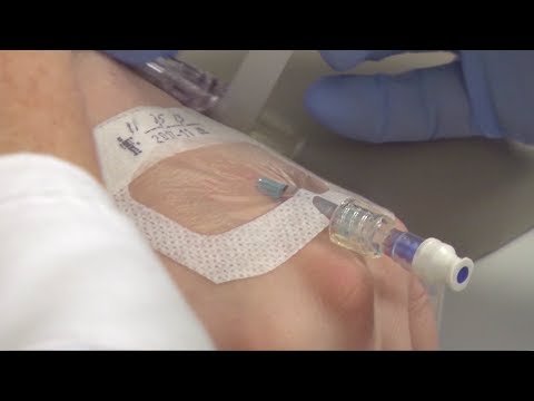 how to perform iv insertion