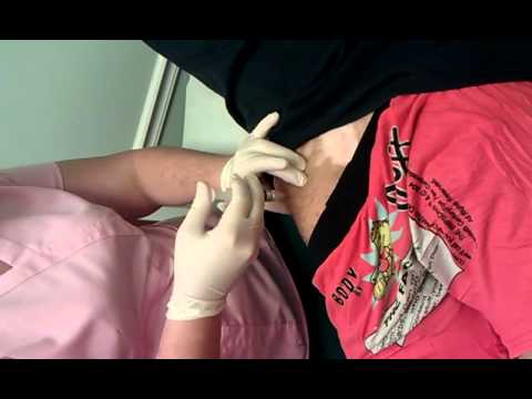 ass injection