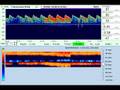 Atysmedical Transcranial doppler