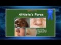 Roast News Update 07/13/12