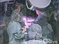 Laparoscopic Adjustable Gastric Banding for Obese Teenagers