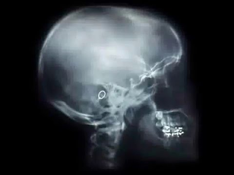 See video