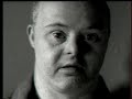 Down syndrome:&nbsp;Sindrome di Down: Special Olympics Italia