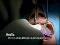 Teeth in an Hour Dental Implants-Dr. Moini-413.739.5685