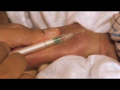 how to administer ppd