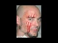 BODY SCARIFICATION TATTOOS