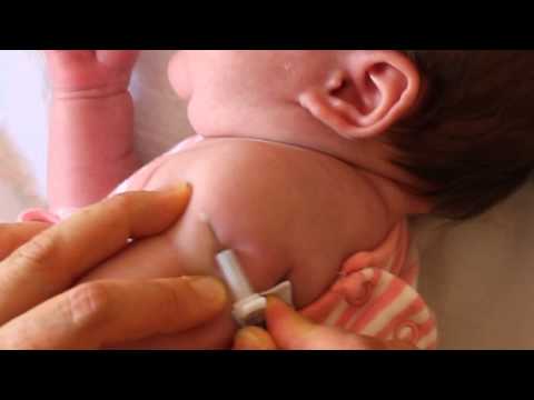 how to administer bcg vaccine