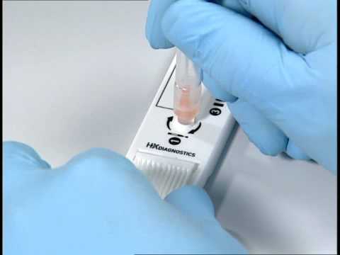 how to test for influenza a and b
