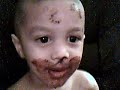 LOL Tristan eating chocolate cake!