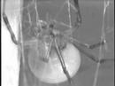 redback spider mating