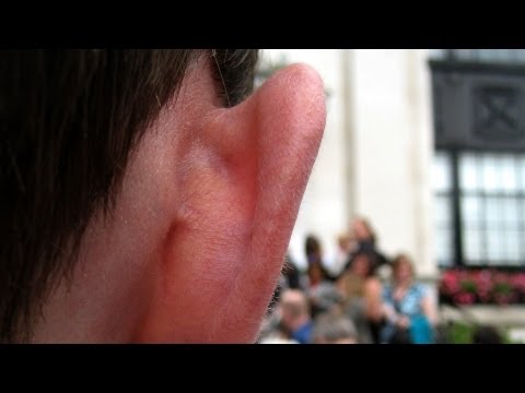 how to relieve outer ear infection