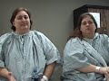 Two Failed Lapband Patients Converted to the MGB