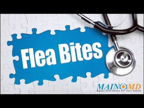 how to treat flea bites