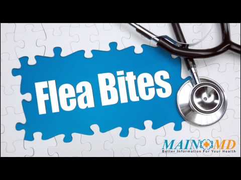 how to cure flea bites