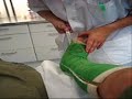 papa niek zijn gips wordt eraf gezaagd