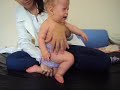 Sete meses apos o inicio da fisioterapia, para adquirir tonus muscular, devido a hipotonia severa, a Maria Eduarda foi diagnosticada com Sindrome Prader Willi, no dia 11/01/2010, mas a evolução dela está sendo satisfatoria a cada dia que passa.
