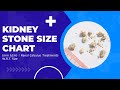 Kidney Stone Size Chart In Mm And Treatment