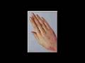 Eczema home cures and remedies eczema