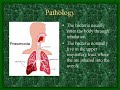 Bacterail Pneumonia-Kassa8
