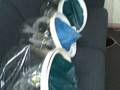 Hyperbaric Oxygen Chamber