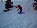 broken thigh bone