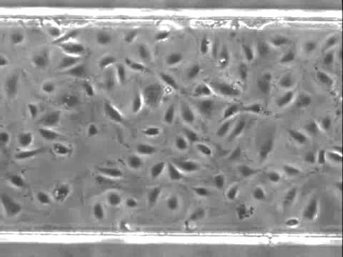 how to isolate endothelial cells from mouse