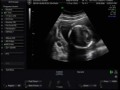 BENJAMIN ALEJANDRO FARIAS ESCANILLA 2