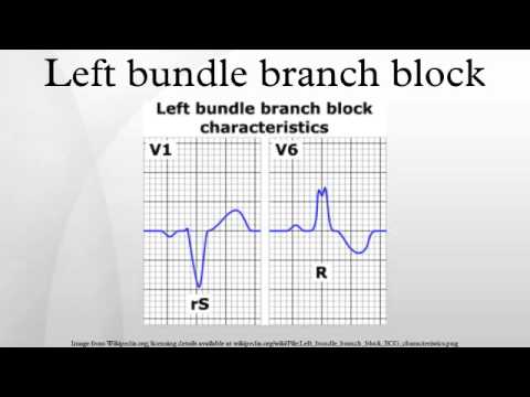 how to treat lbbb