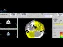 Advanced cancer treatment with TomoTherapy Advanced cancer treatment with TomoTherapy