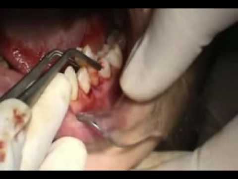 how to replant tooth