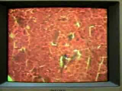 Salivary Glands & Pancreas Lab Part ...