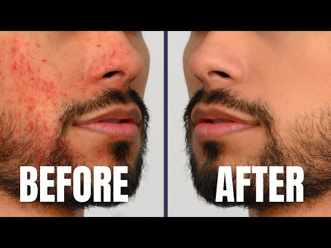 7 Skin Care Tricks Attractive/Handsome Guys Do DAILY