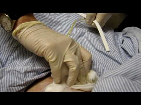 how to pull a jp drain