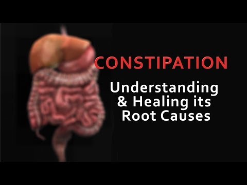 how to relieve severe constipation