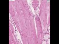 Shotgun Histology Lingual Tonsil