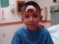 Eli's 1st Stiches