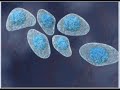 Stem Cells/T1 Diabetes Remission from JAMA Stem Cells/T1 Diabetes Remission from JAMA