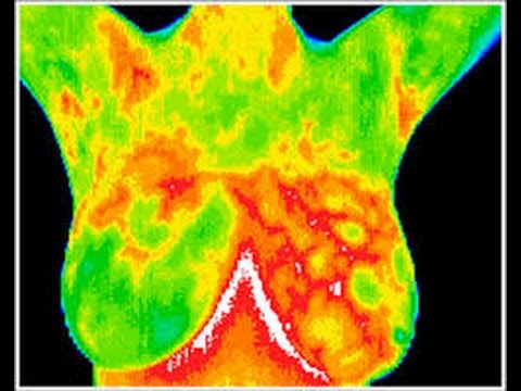 how to relieve cyst pain