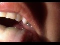 Christian's tonsils