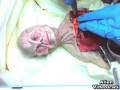 Humanoid Autopsy