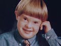 Your Child's Health: Down Syndrome Rehabilitation