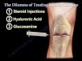Knee pain ,arthritis and Injured Cartilage - Everything You Need To Know - Dr. Nabil Ebraheim, MD