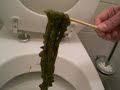 mucous.colon cleanse,mucoid plaque mucous.colon cleanse,mucoid plaque