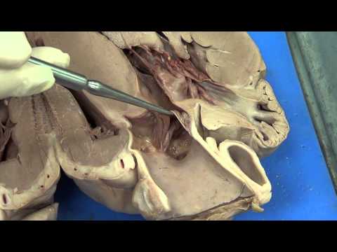 Heart dissection (Pig)