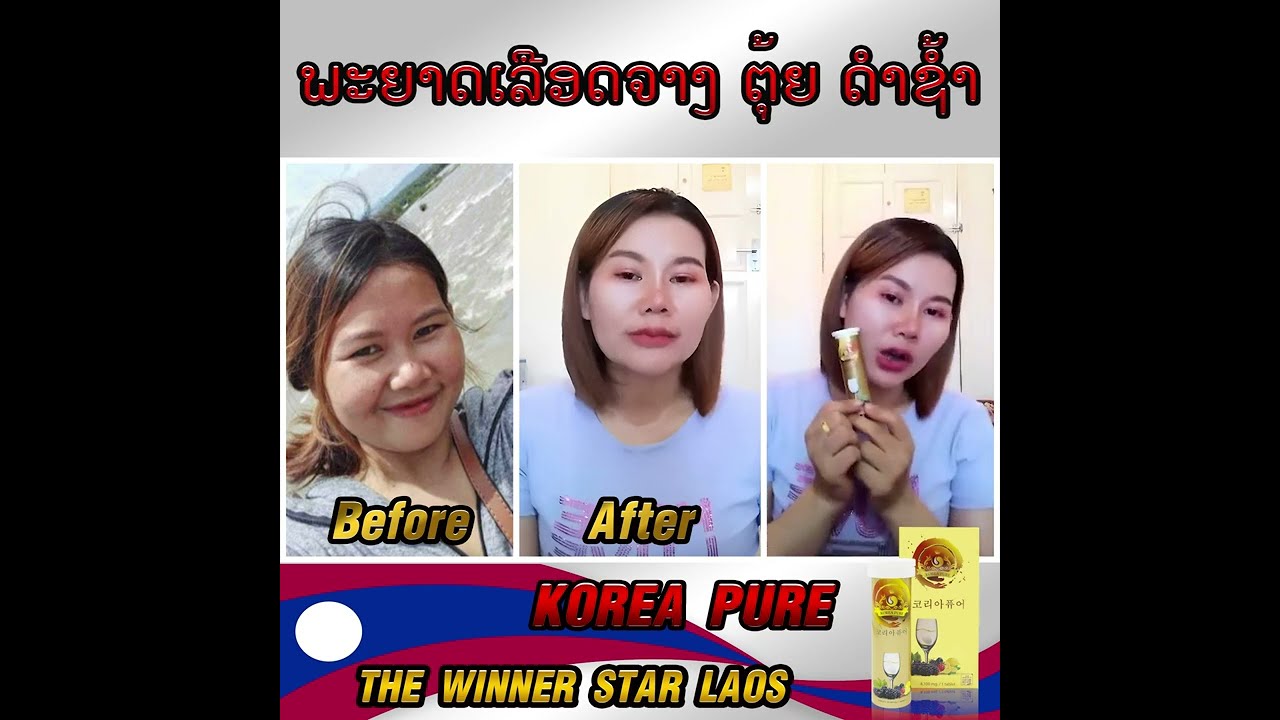 Korea Pure Review By ມະນີວັນ ມີໂນລາດ