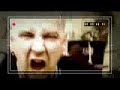 Frontside - Zapalnik (Oficjalny Teledysk)